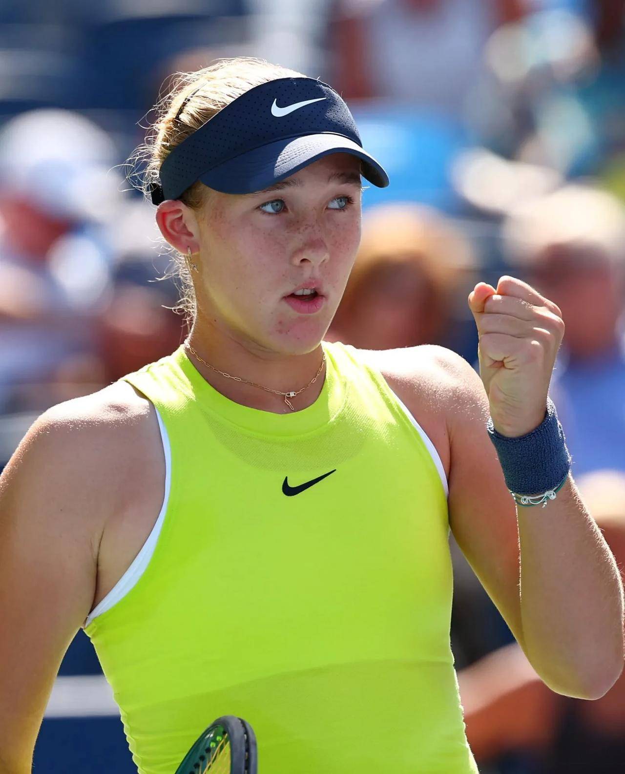 管理上维持 管理上维持